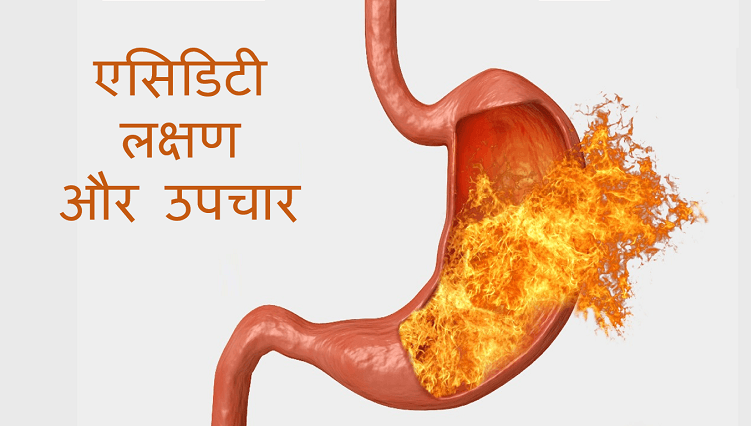 Acidity Symptoms and Treatment